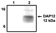 "
Immunoprecipitation using DAP12 antibody on MHC class I (1) and NKp44 (2) positive cells."